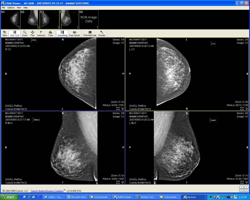 CoActiv Breast Imaging